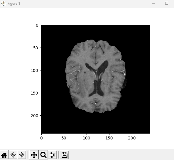 神経画像データのサンプル画像